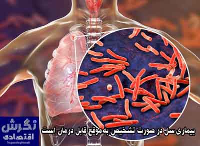 بیماری سل در صورت تشخیص به‌موقع قابل درمان است